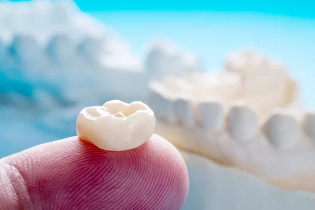 Close-up of a dental crown on a fingertip, illustrating high-quality crown restorations at Six Point Dental.