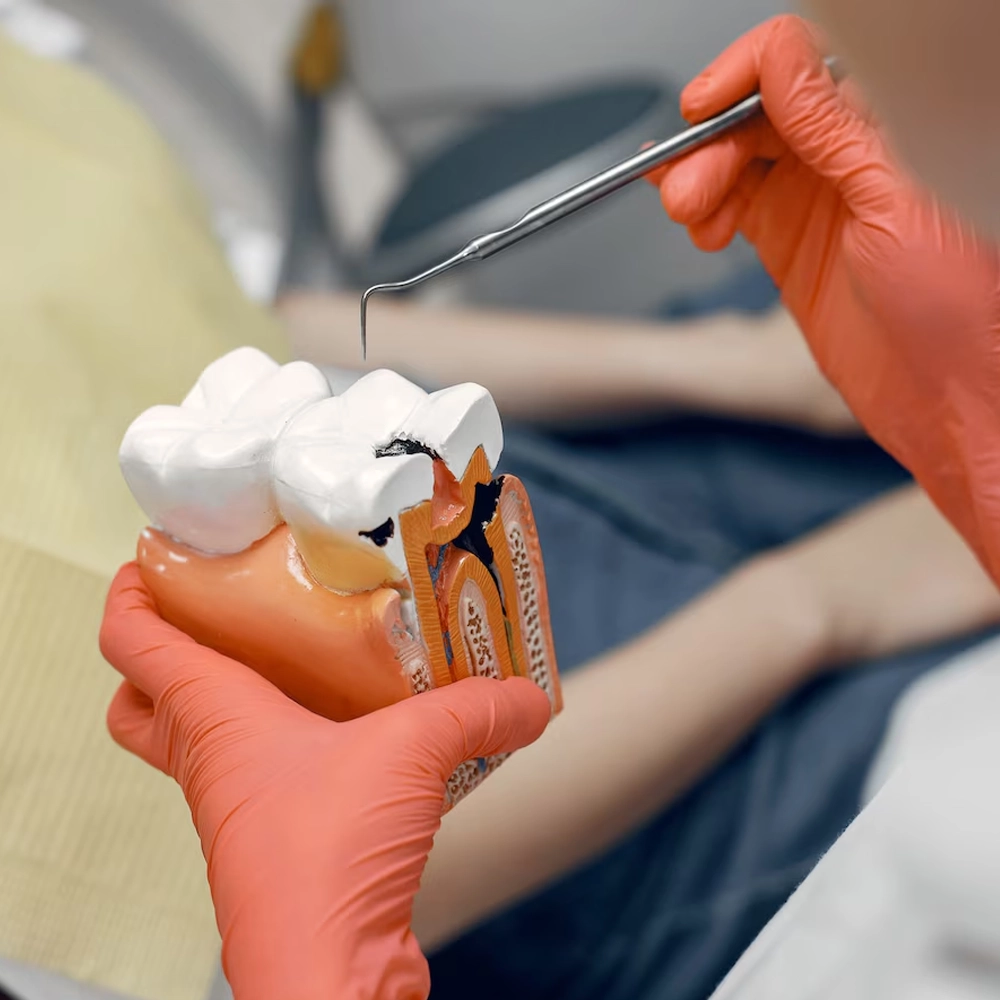 Root Canal Treatment Depiction