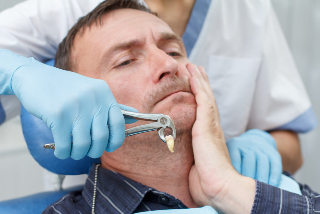 A dentist performing a wisdom tooth extraction on a male patient, using forceps to remove the tooth, while the patient holds his cheek in discomfort.